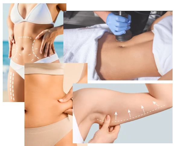 Body Contouring