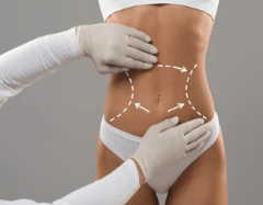 Body Contouring