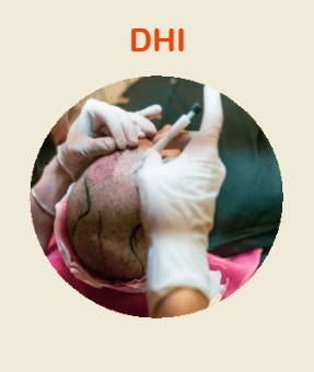 DHI Hair Transplant 