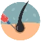Hair Transplant 3 1