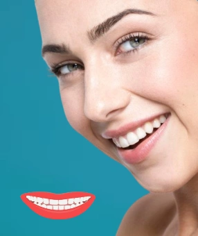 Hollywood smile