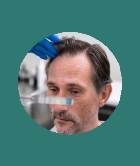 Unshaven Hair Transplant